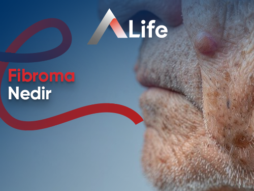 Fibroma Nedir ?